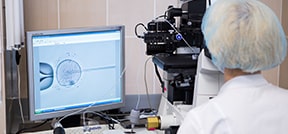 体外受精服务 体外受精服务